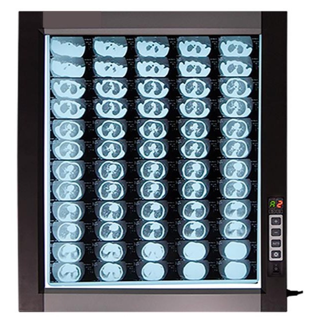 NEGATOSCOPIO SENCILLO LED - Imagen 2